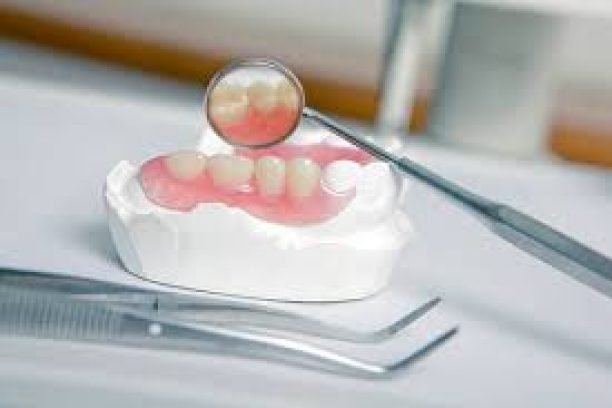 Full Denture (Acrylic)